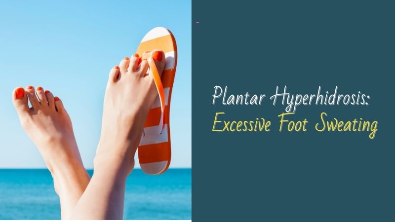 Plantar Hyperhidrosis Excessive Foot Sweating