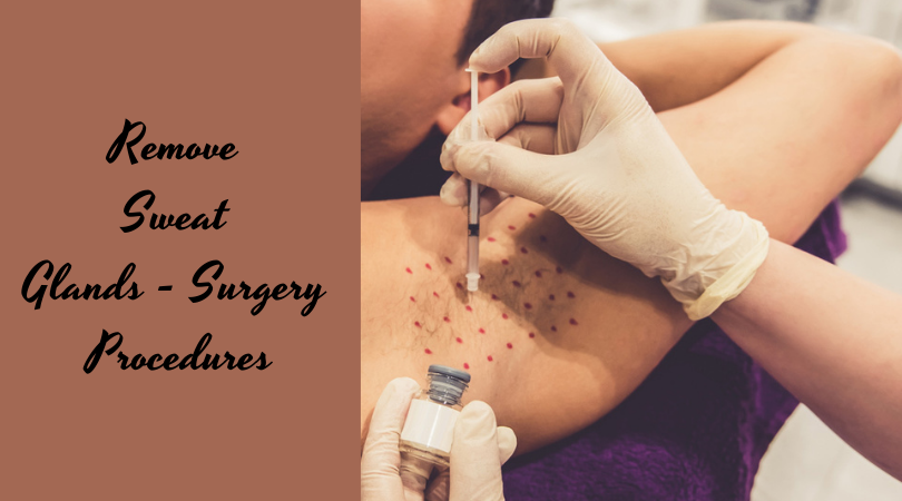 Remove Sweat Glands - Surgery Procedures