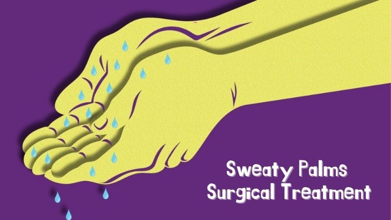 Sweaty Palms Surgical Treatment