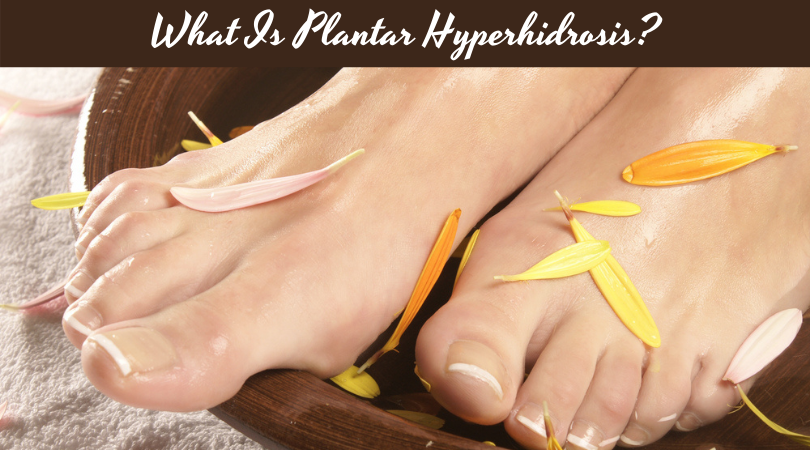 What Is Plantar Hyperhidrosis