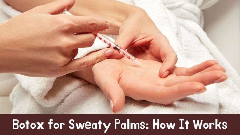 Botox for Sweaty Palms How It Works