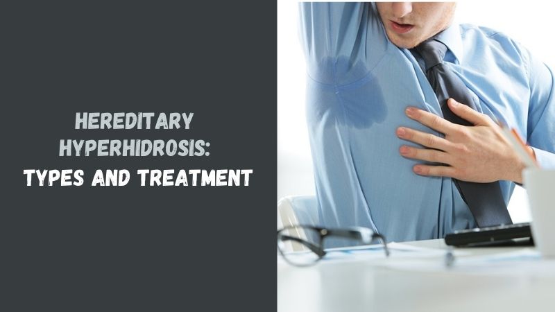 Hereditary Hyperhidrosis Types and Treatment