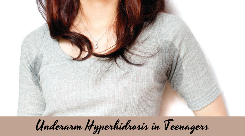 hyperhidrosis in teenagers