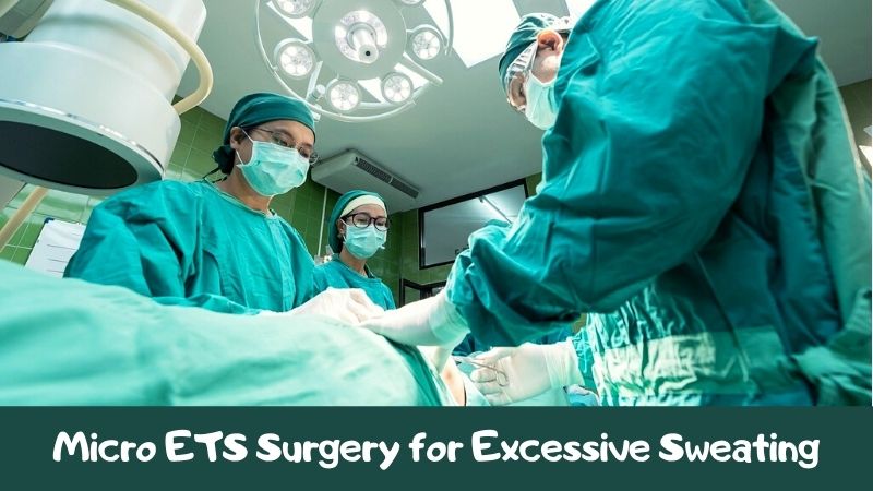 Micro ETS Surgery for Excessive Sweating