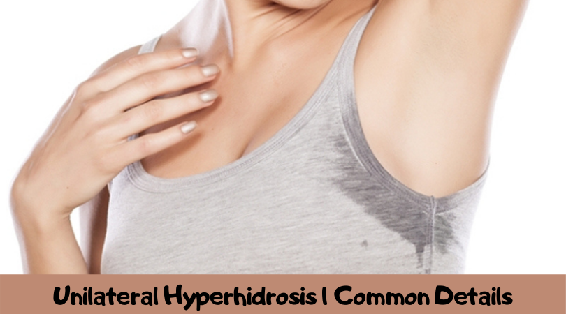 Unilateral Hyperhidrosis Common Details